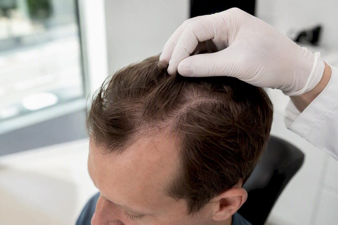 Was tun bei erblich bedingtem Haarausfall?