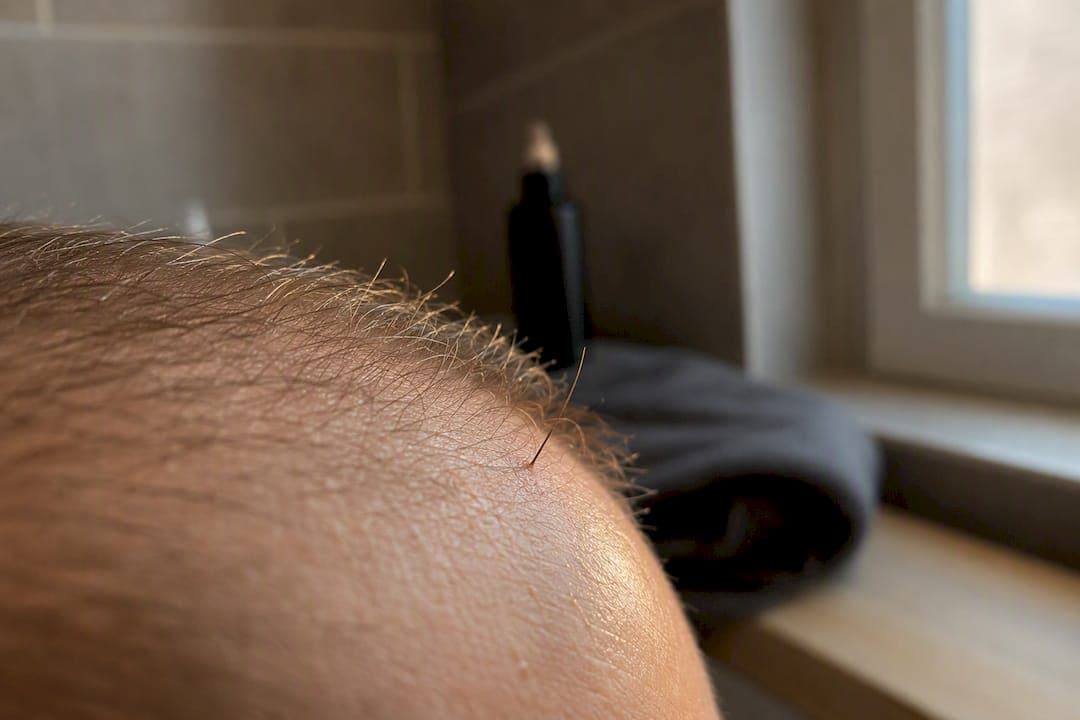 Was ist ein Haarfollikel? Aufbau, Funktion und Bedeutung