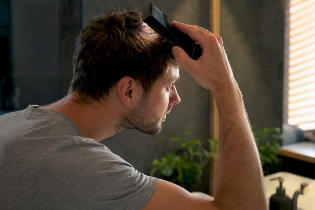 Geheimratsecken stoppen: Checkliste, Tests und MyHair.ai Scan