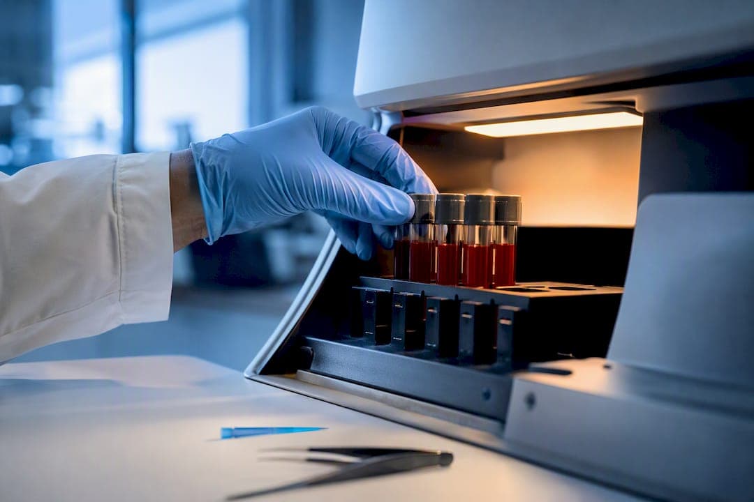 Ferritin zuerst: Haarausfall durch Eisenmangel in Deutschland erkennen und behandeln