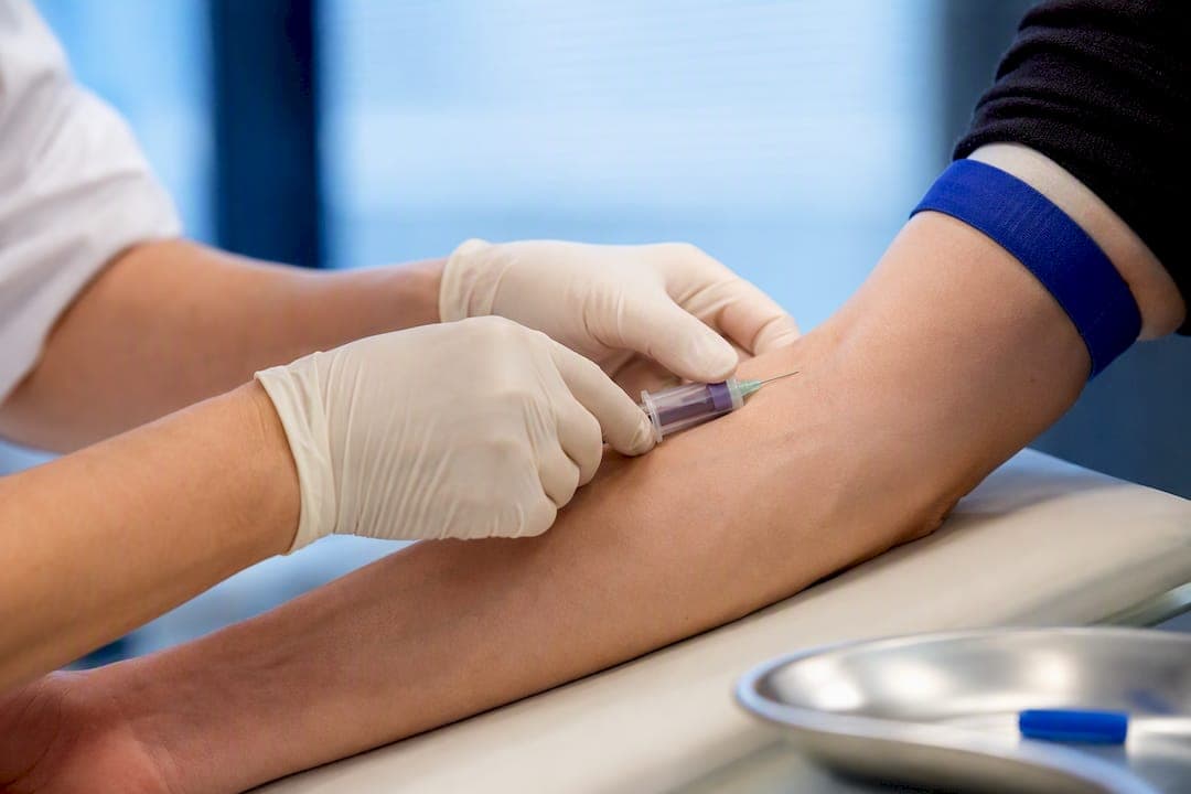 8–12 Wochen: Ferritin prüfen und Fototracking bei diffusem Haarausfall