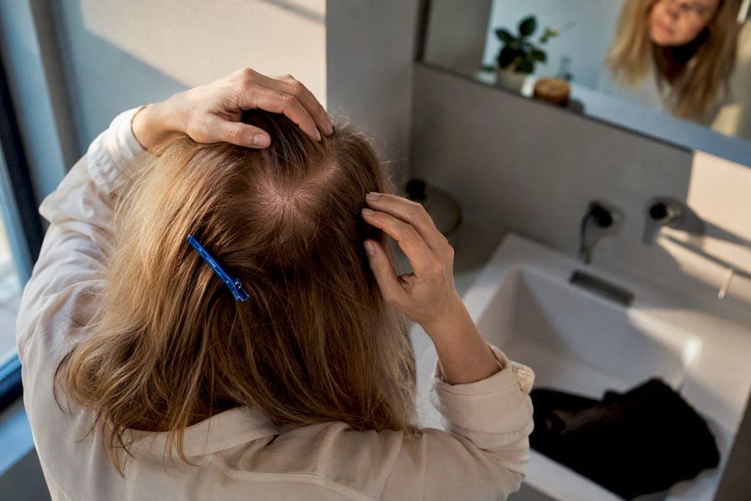 Haarausfall bei Frauen: Was hilft wirklich gegen Ausfall?