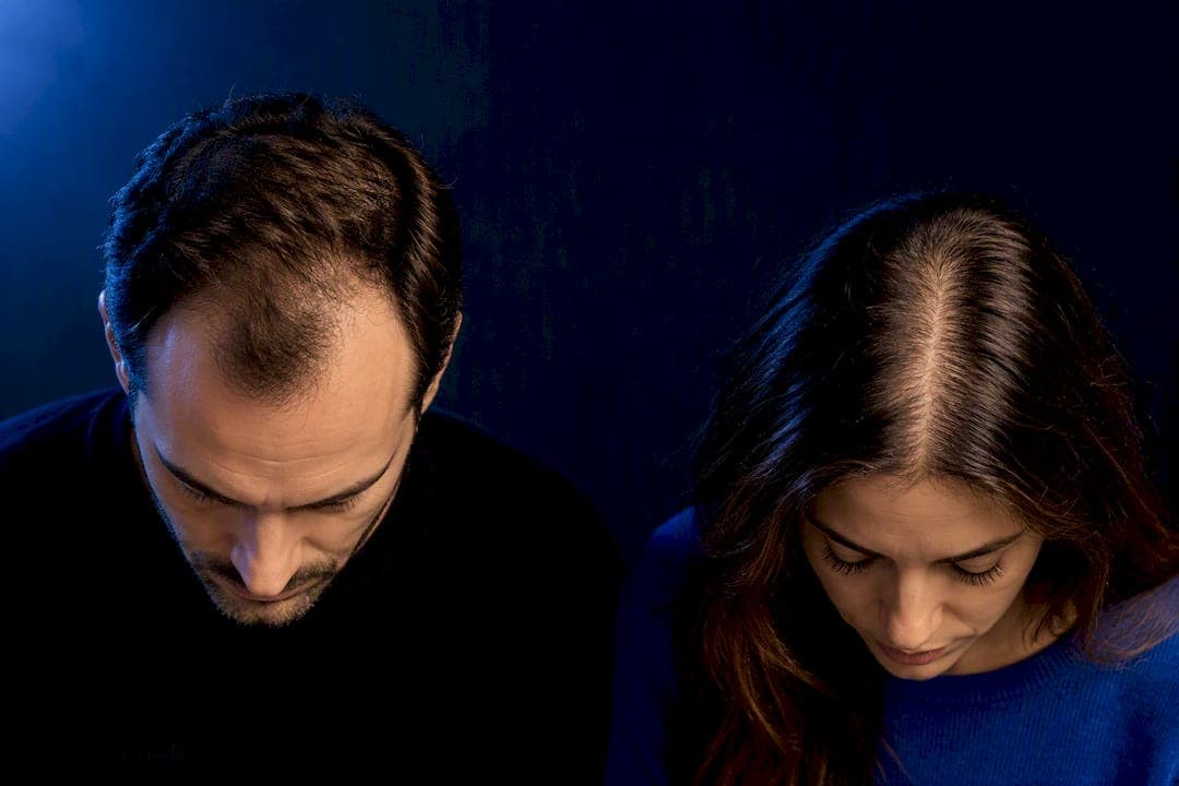 Alopecia androgenética: causas genéticas y qué hacer al respecto