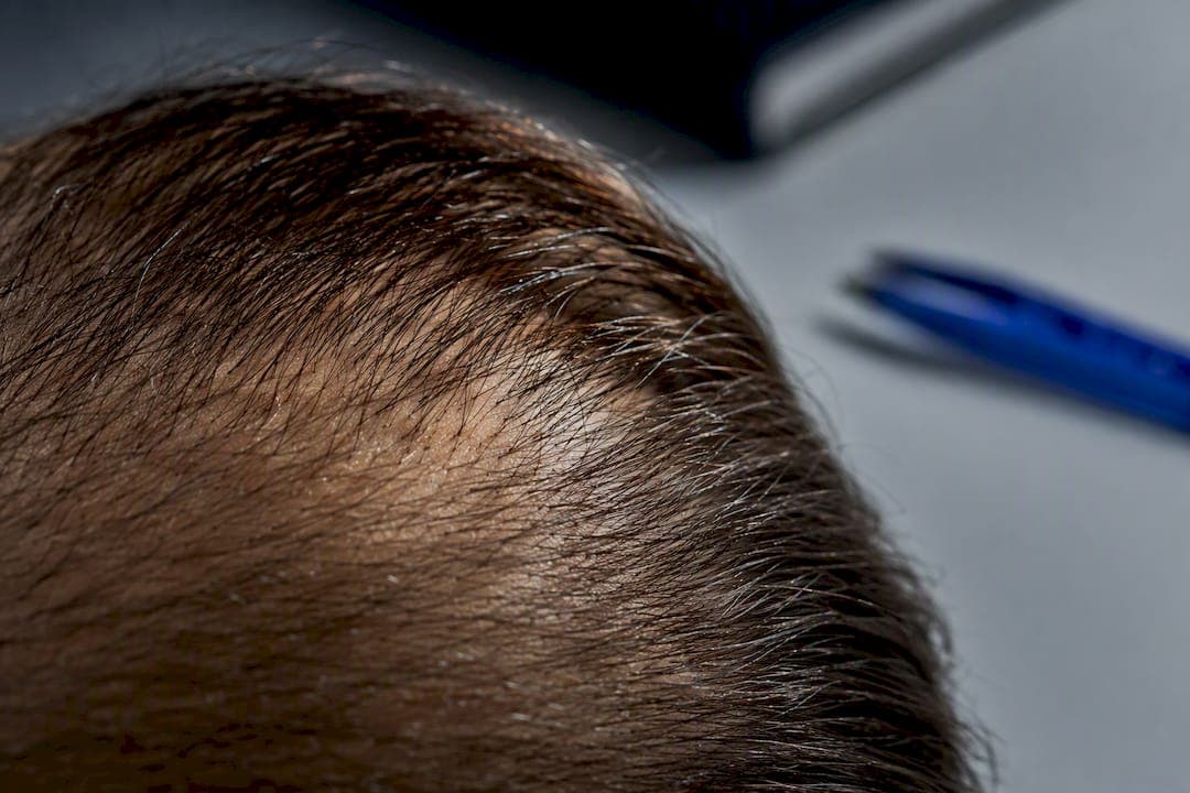 ¿El pelo vuelve a crecer tras la caída? Lo que dice la evidencia