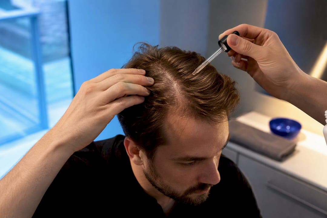 Was tun bei Haarausfall? Ursachen, Diagnose und wirksame Schritte