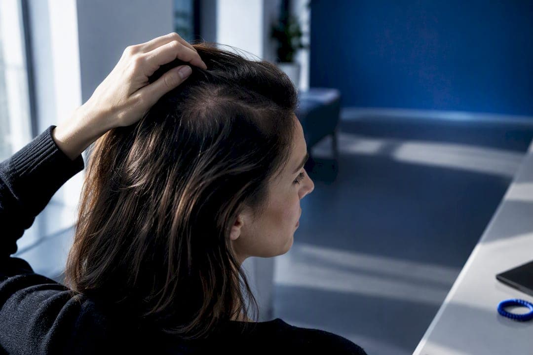 Alopezie Ursachen: Die wichtigsten Auslöser im Überblick