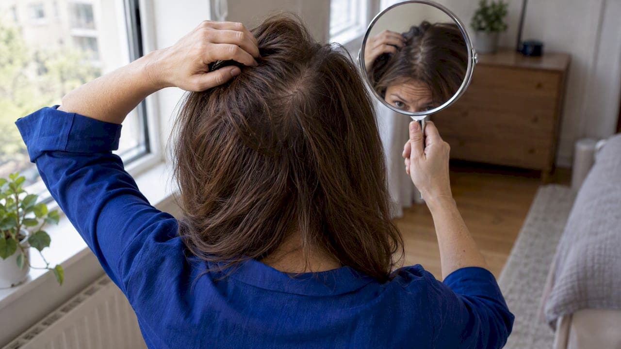 Qué puede ayudar la alopecia según su tipo y causa