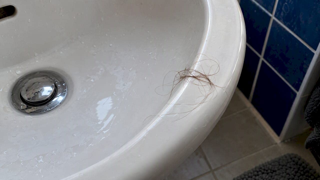 Por qué se cae el cabello: causas, señales y qué hacer
