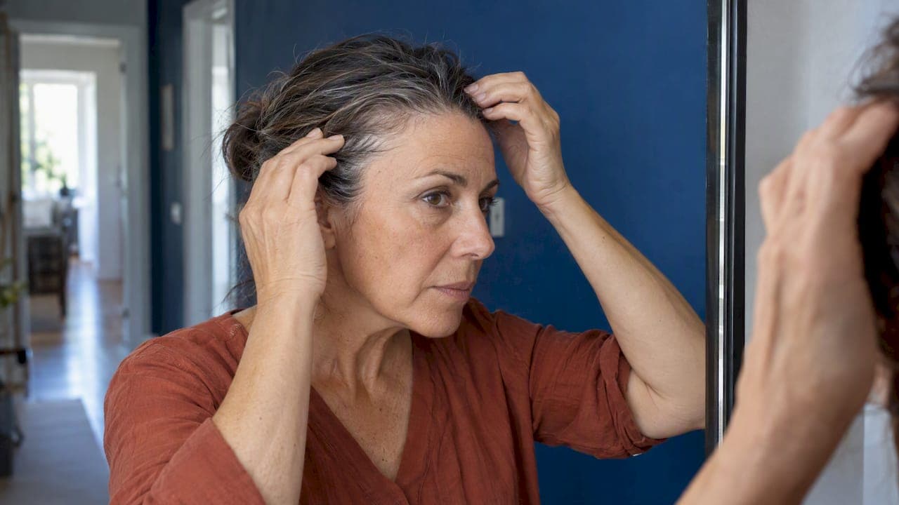 Alopecia frontal fibrosante: síntomas y primeras señales